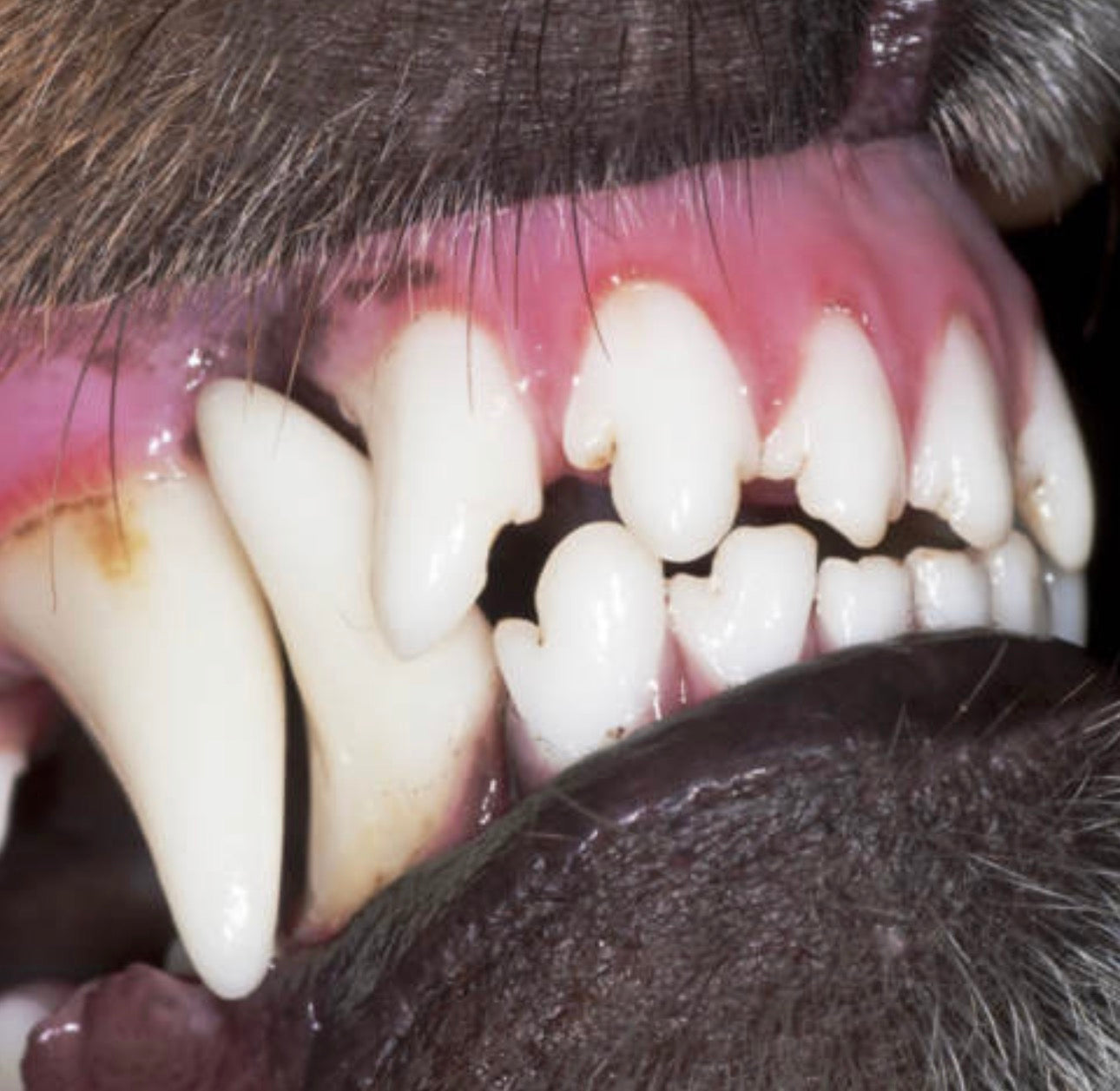 DENTAL CLEANER